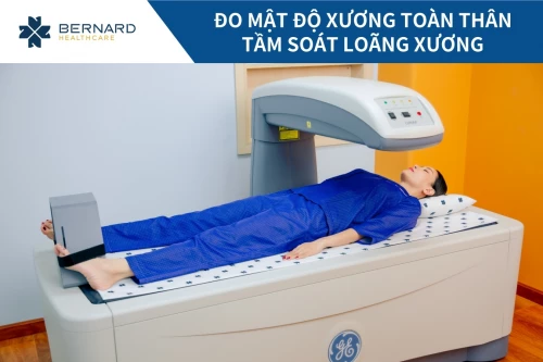 Đo mật độ xương toàn thân tầm soát loãng xương